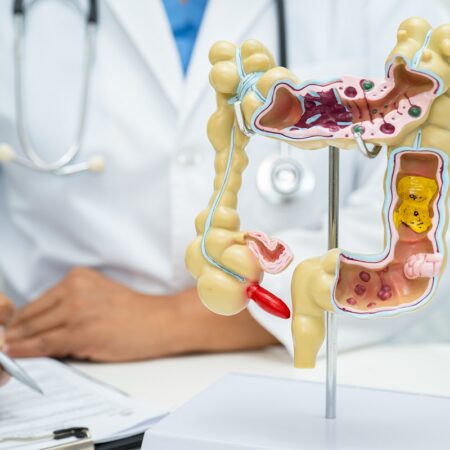 Intestine, appendix and digestive system, doctor holding anatomy model for study diagnosis and treatment in hospital.